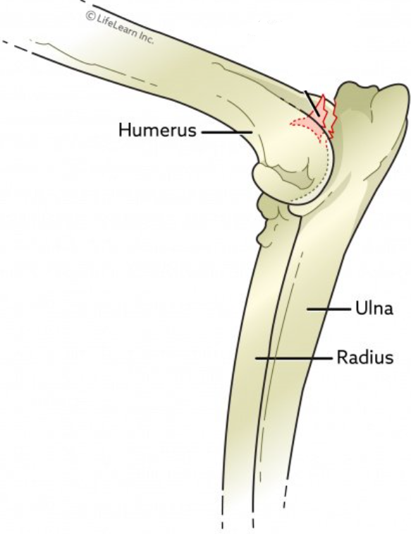 elbow joint