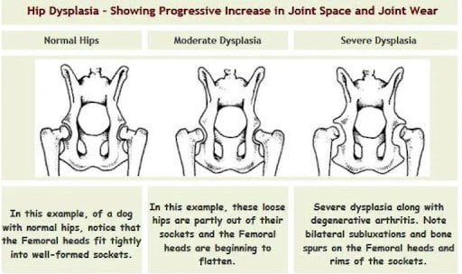 dysplasia anatomy