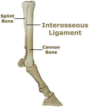 inflammation of the ligament