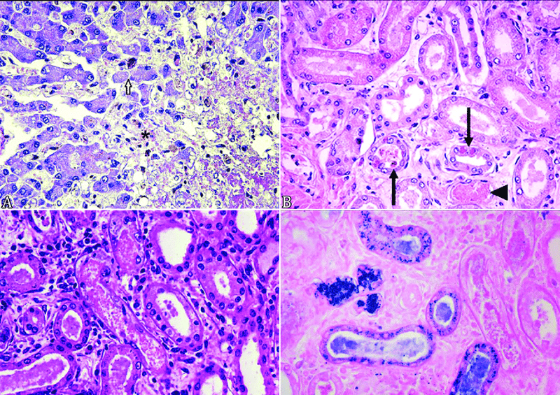 Histologic-lesions-in-dogs-with-leptospirosis-A-Adult-male-White-Swiss-Shepherd-dog